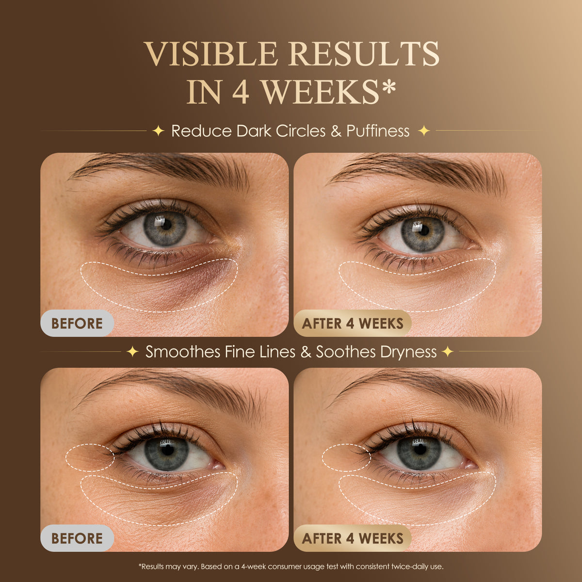 Under Eye Serum for Dark Circles & Puffiness : Caffeine Retinol Peptide Eye Serum for Fine Lines and Wrinkles, Hydrating Daily Eye Care for Women & Men, 0.7 fl oz