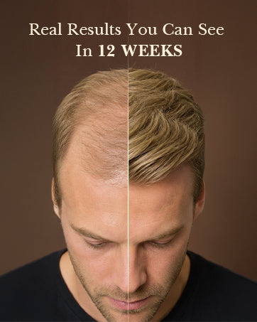 Hair Growth Serum Spray for Women and Men, Thinning Hair, 2.0 Fl Oz