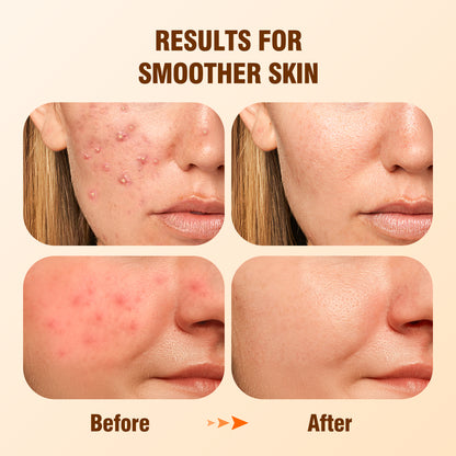 Biysber Salicylic Acid Serum